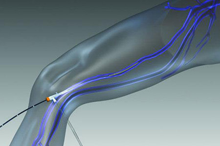 pain treatment service